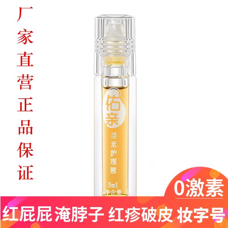 Well-friendly baby oil baby special red fart flooded neck breaking skin freshly protected hip natural no thrill