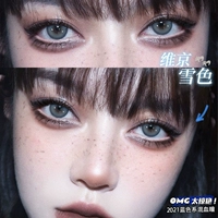 14.2mm