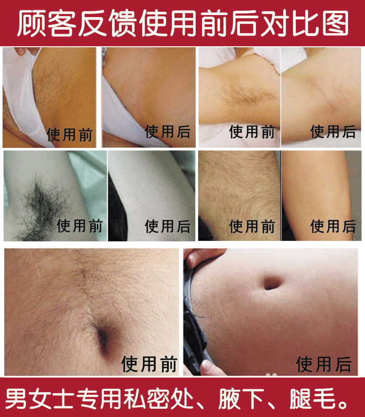 去除腿毛阴毛肛毛专用私密处不永久私处脱毛膏腋毛男女士脱毛肛门 五折优惠 腋毛 阴毛 脱毛 肛门 去除途虎网