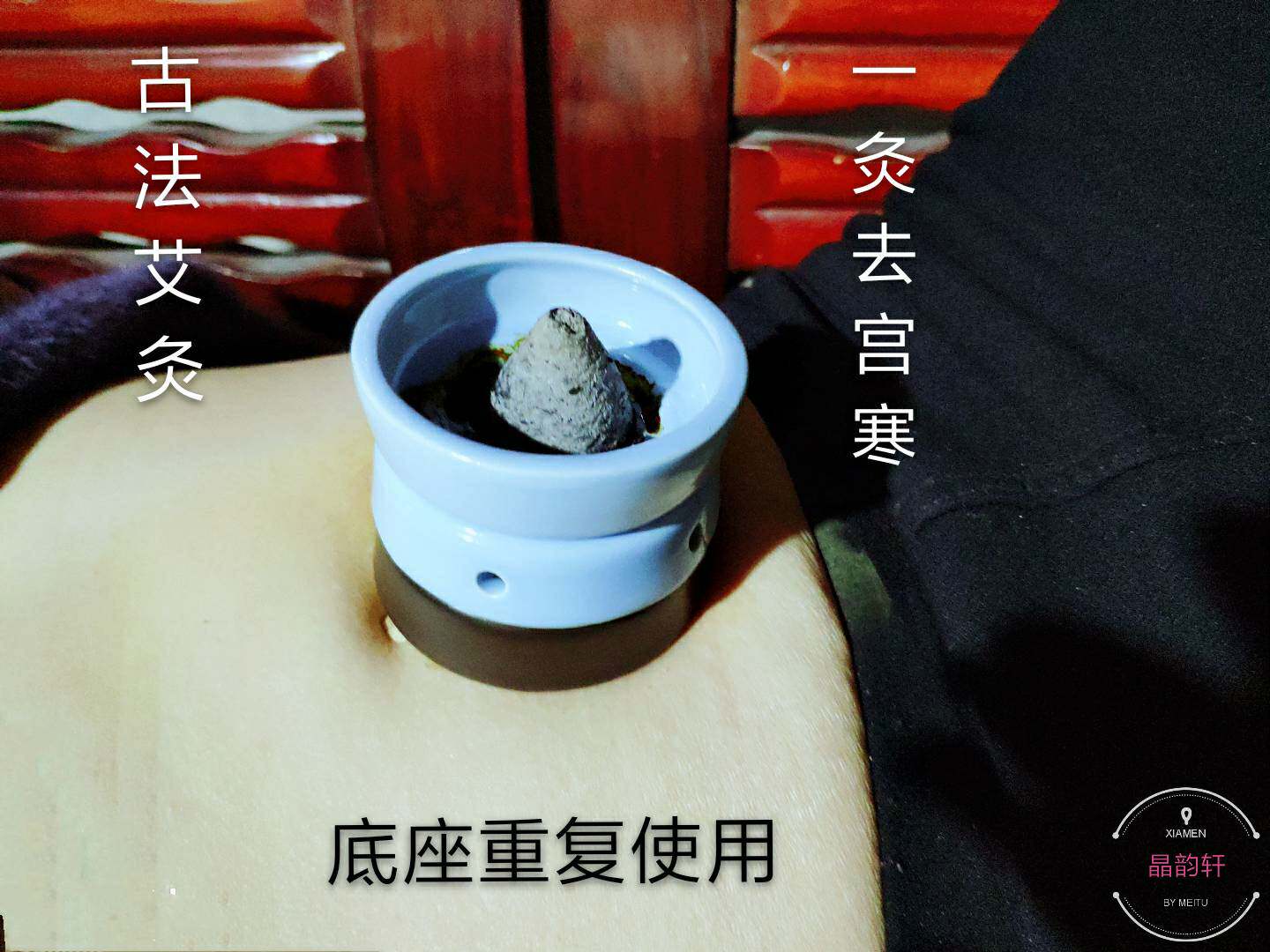 Ginger-partition moxibustion Aita Aituo moxibustion portable moxa moxibustion appliance household moxibustion neck waist navel moxibustion fumigation instrument