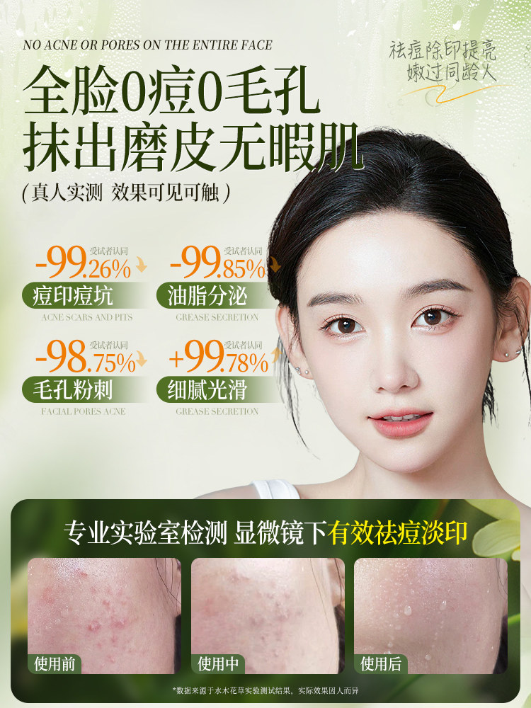 Water Emulsion Set, Hydrating and Moisturizing, Student Oil Control, Acne Removal, Pore Shrinking, Whitening, Men's Genuine Official Flagship Store