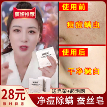 Silk soap to remove mites acne whitening back washing face black head back facial women water mites mites