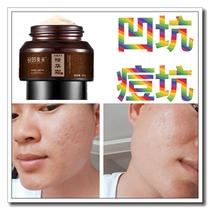 Remove caesarean section scars remove facial depression and acne scars fill acne marks and pits repair mens facial mask concealer cream giant