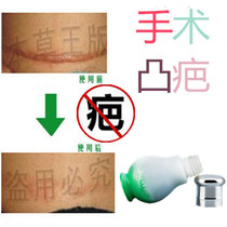 Remove stitches and repair injuries caused by falls and bumps cesarean section convex scars constitution scars scars cigarette burn ointment