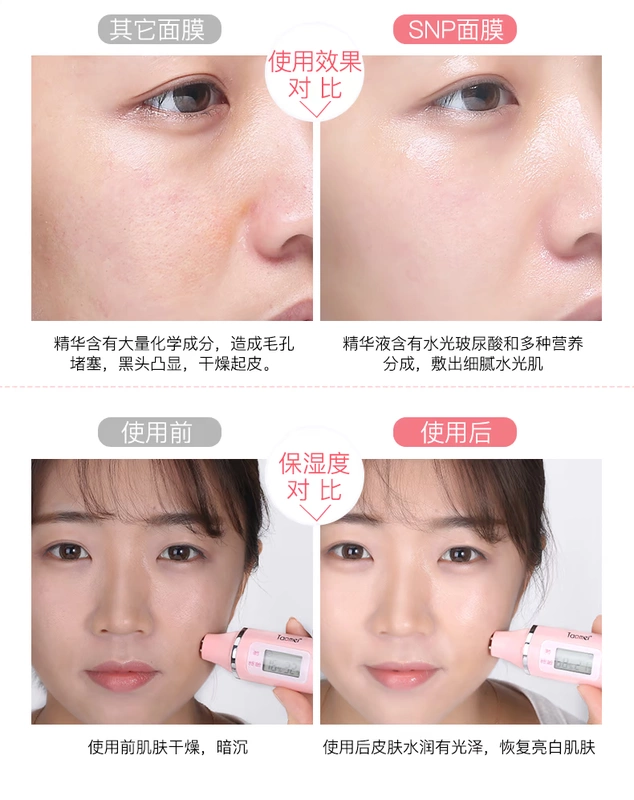 SNP mặt nạ chim yến dưỡng ẩm làm sáng da thu nhỏ lỗ chân lông Hàn Quốc nam và nữ sinh viên đích thực - Mặt nạ