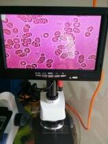 Microscope Display Electronic Eyepiece Microscopy Camera 7 Inch HD Screen