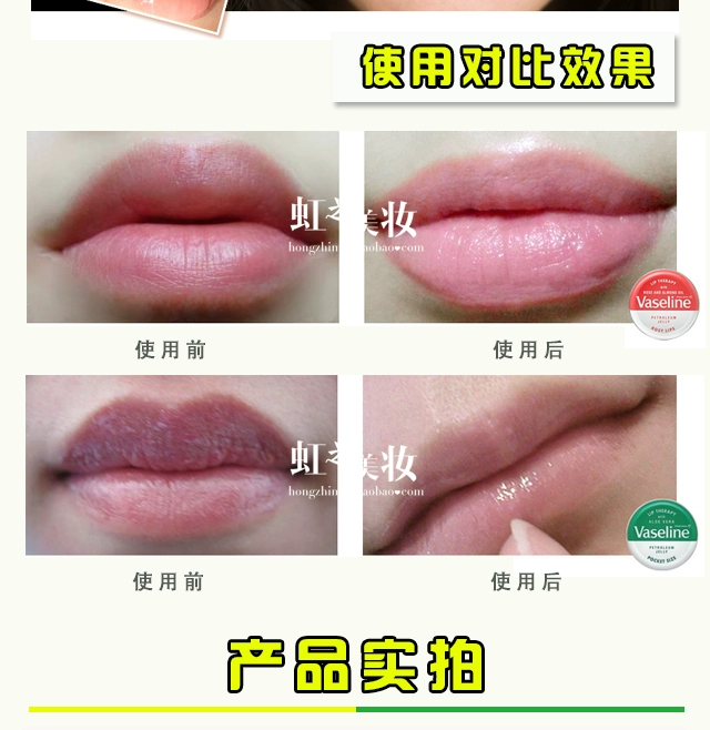 Gửi cọ môi Anh Vaseline Vaseline lip balm 20g lip balm lip balm box cho nam và nữ exo - Son môi