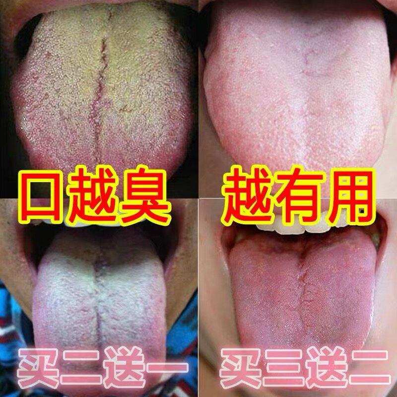 Bad breath tongue moss white thick conditioning intestine appetite qi heavy three clear tea in addition to dry mouth bitter to stomach fire liver fire wang male and female