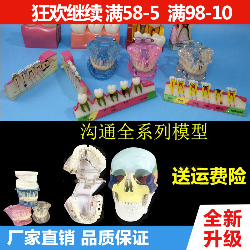 牙科材料牙齿教学模型透明病理牙模白钢玉牙头骨蛀牙模型种植玩具