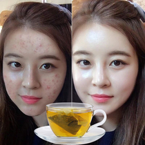 Red beans barley dampness tea red beans non-detoxification body moisture heavy