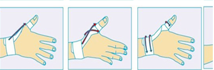 Protection sport - Ref 586142 Image 13