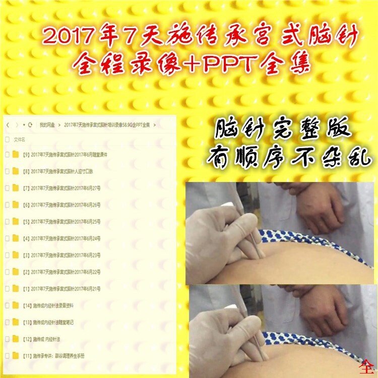 Brother Cheng-Shi Inheritance-Gong's Brain Acupuncture 2017 7-day training 53G video and courseware