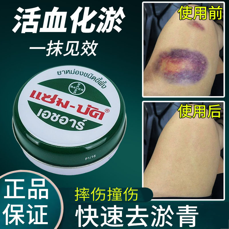 Collision of bruised and bruised blood special bruises for quick elimination of pain and desilting soothing to soothe violinache-Taobao