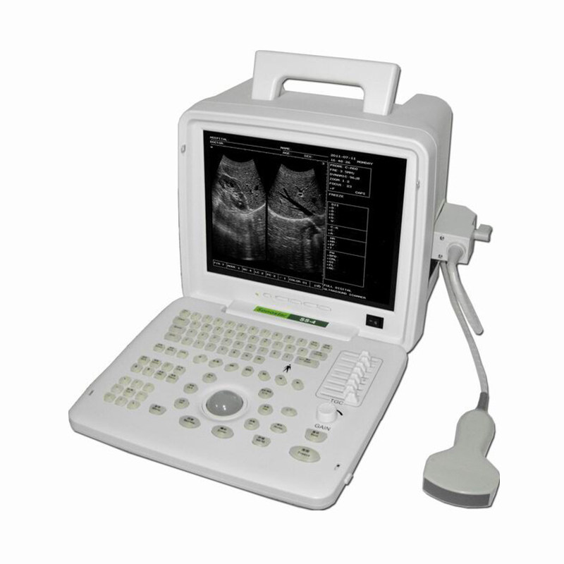 Black and white B-ultrasound portable B-ultrasound portable B-ultrasound SS-6 type ultrasonic diagnostic instrument small B-ultrasound digital black and white ultrasound
