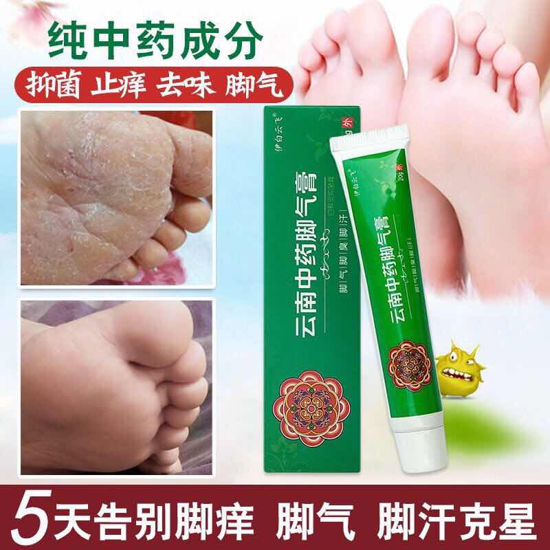 Yunnan traditional Chinese medicine feet qi and feet girl hands and feet Hong Kong Peeling Sweat and Sweat Paste Buy 2 to send 1 3 to 2