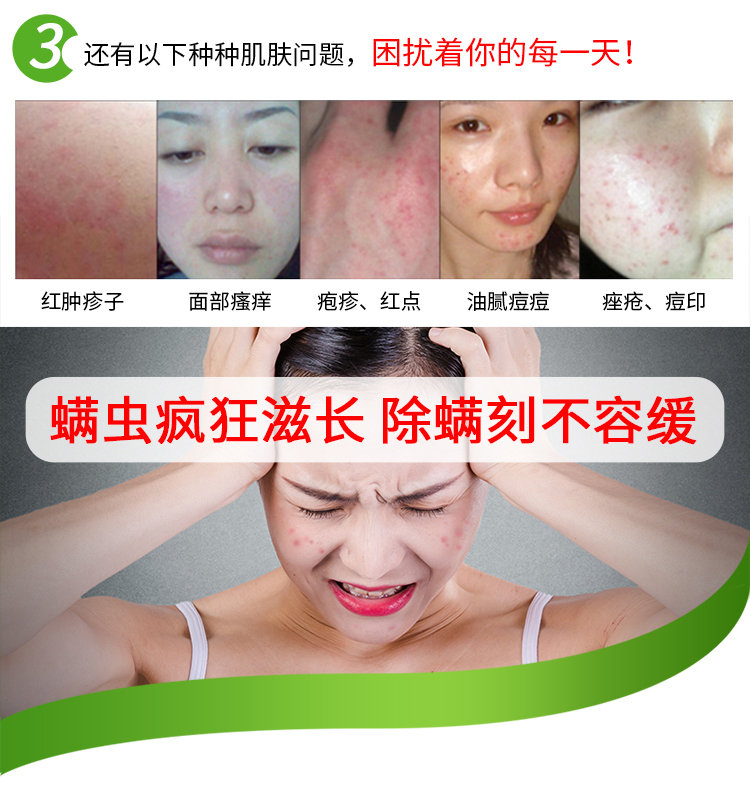bình xịt muỗi bằng điện Yukang ngoài túi mite tự nhiên dán vào mạt tạo tác ngoài mite dán giường ngoài pad chống mạt rửa - Thuốc diệt côn trùng xịt côn trùng