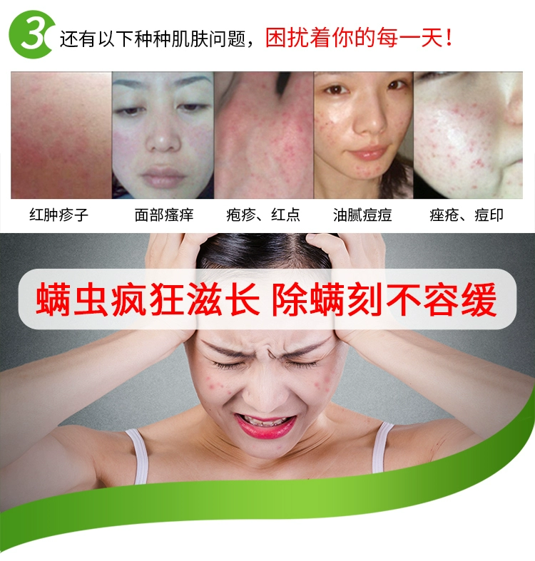 Yukang ngoài túi mite tự nhiên dán vào mạt tạo tác ngoài mite dán giường ngoài pad chống mạt rửa - Thuốc diệt côn trùng