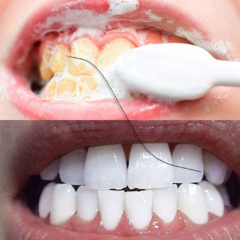 (Dentist recommended) White teeth washing powder is more beautiful, smile more confident not hurting gums ~ buy two delivery one
