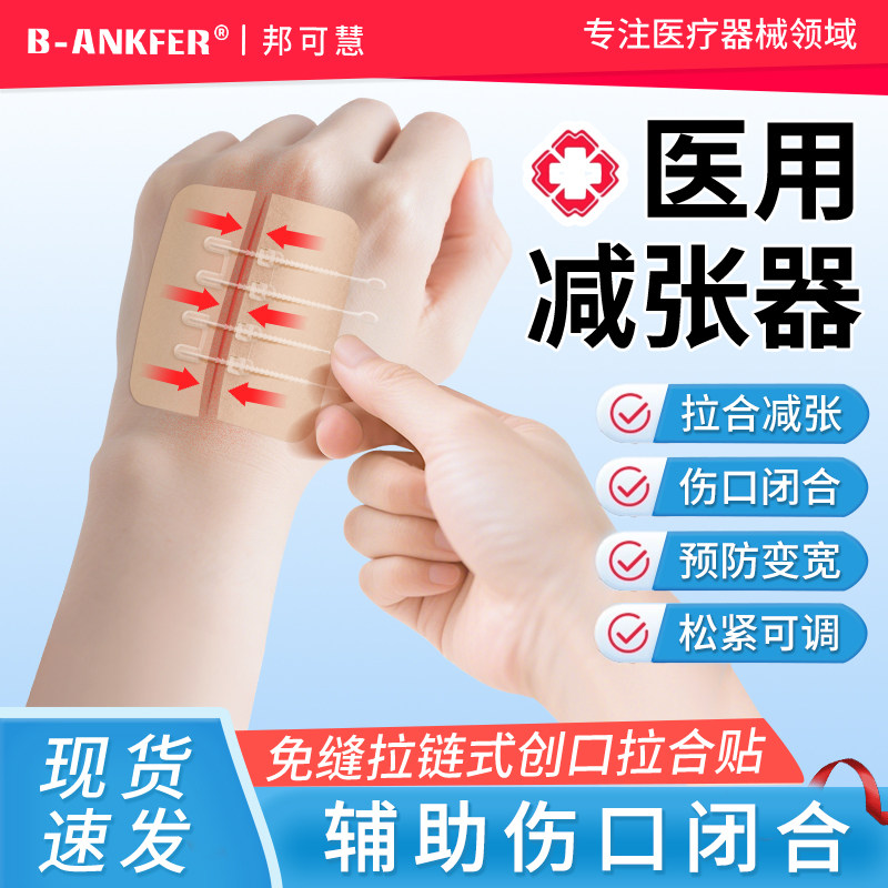 皮肤减张器伤口医用疤痕手术剖腹产儿童术后拉链伤口贴免缝减张贴