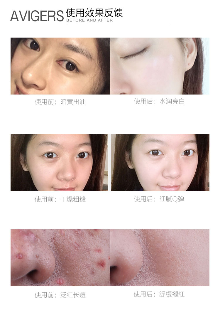 Jinlan làm đẹp cửa hàng trang điểm Avigers enzyme làm sạch bột Jia Nailiang đẩy Ai Weige làm sạch sâu tẩy trang chính hãng - Chất tẩy rửa sữa rửa mặt cosrx salicylic acid