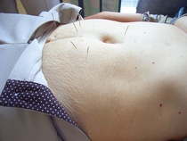 Yue Liyong China shake needle on-site training video picture tutorial