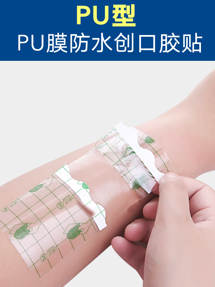 Hongsheng thạch cao Acupoint Đã đăng phim PU không thấm nước cố định Medical Dính vải Dressed Miệng Dao Miệng Băng dính thoáng khí 