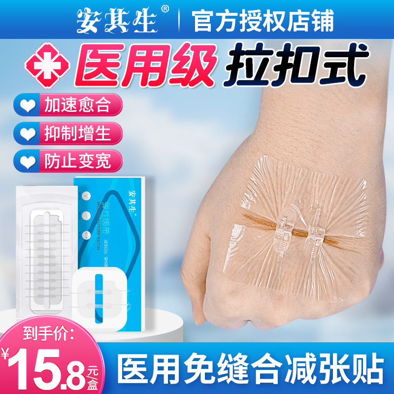 安其生医用伤口减张器免缝合剖腹产术后拉合刨腹产减少疤痕减张贴