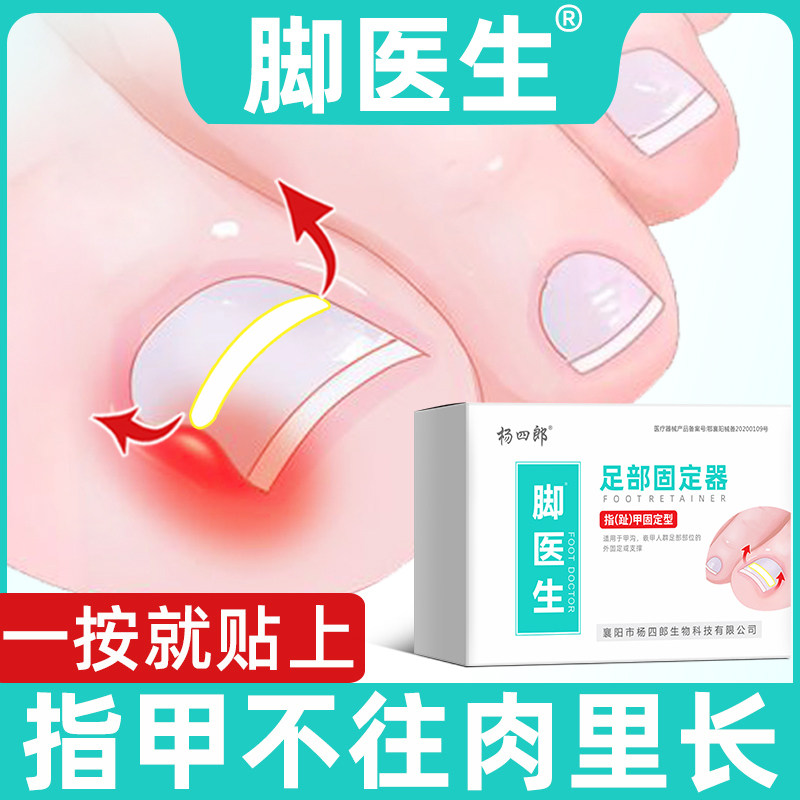 Foot doctor Zhengchia Patch Chia Chia Chia Chia special Lara toenails nail gang orthodontic straightaway sticking patch long meat-Taobao