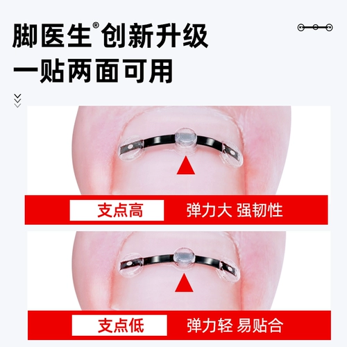 脚医生 Корректор пятна исправления ногтя на ногах