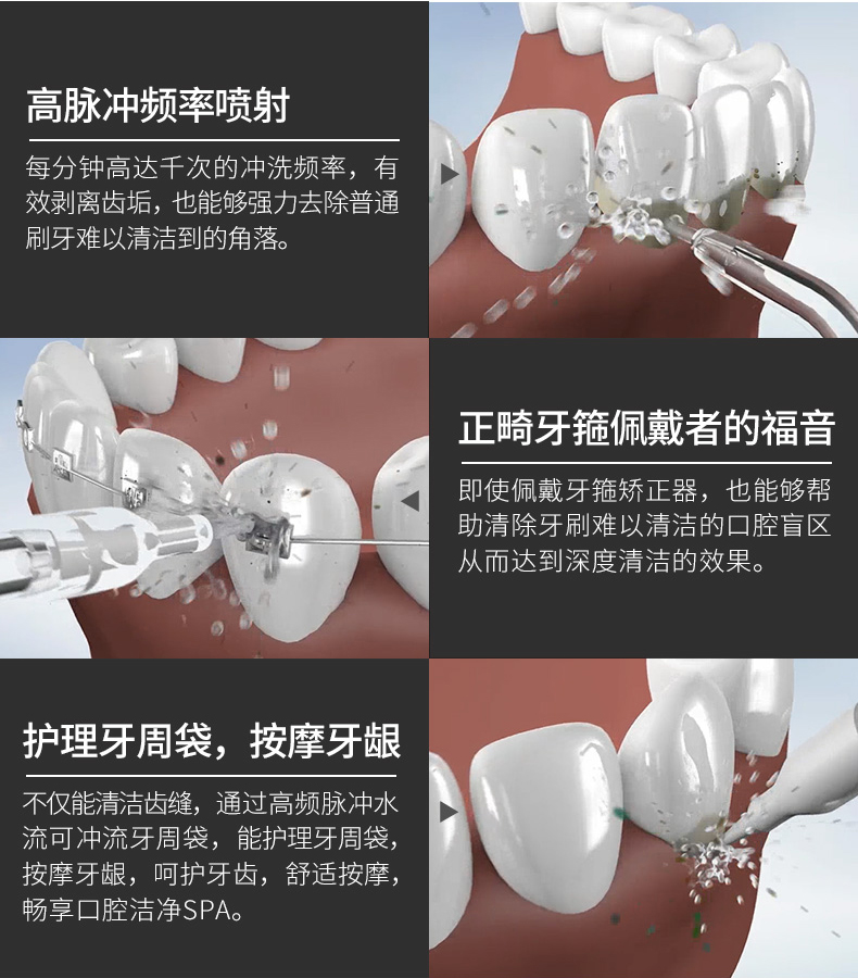 Molux 高频脉冲 电动冲牙器 图3