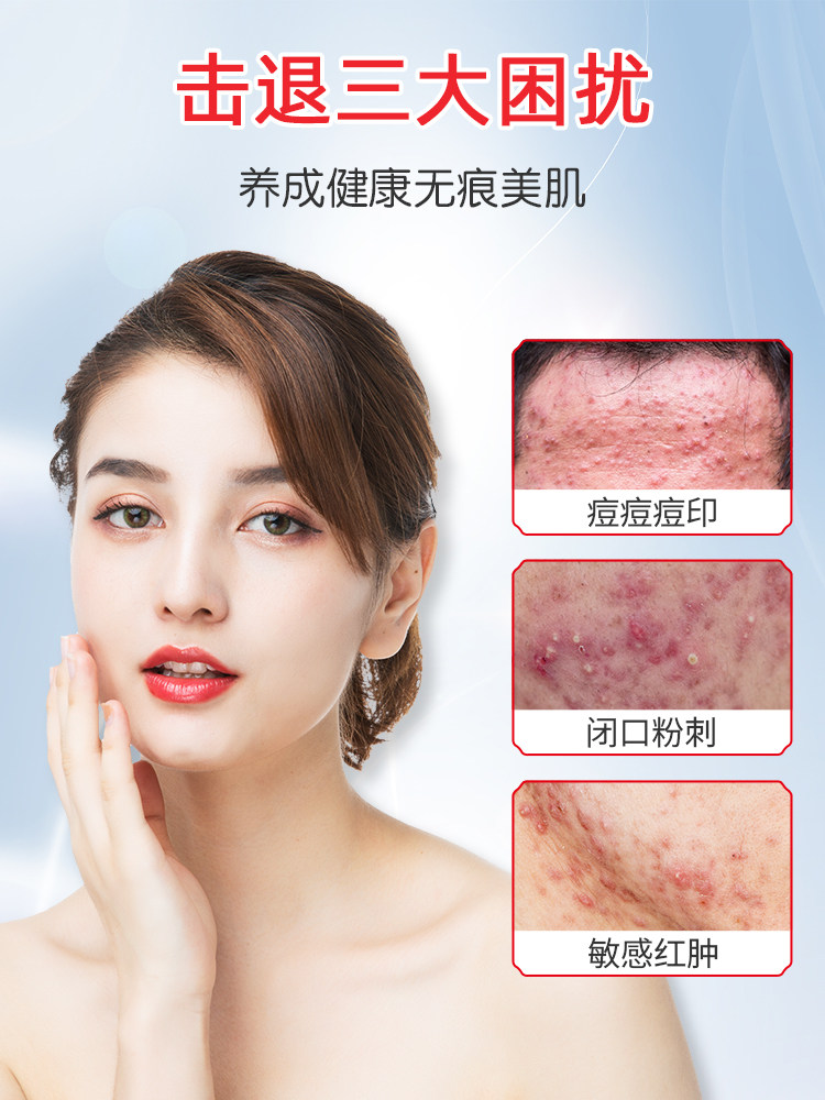 Baiyun Mountain cold compress paste Sensitive skin sterile post-sun repair acne lighten acne marks Moisturizing moisturizing