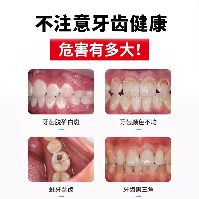 儿童牙齿脱矿怎么办?2026年新型非牙膏涂氟方案大揭秘!-牙齿防龋-淘宝百科网