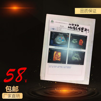 (17 5S) High-light ceramic white 16K 184*260 Medical color printing tables B ultra-color more than 2000 boxes