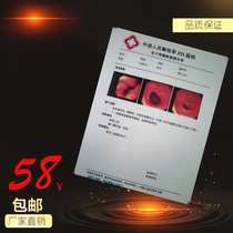 (17 5S) high light porcelain white A4 210 * 297 medical color printing film B supercolor supermedical film