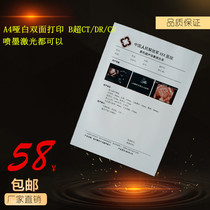 A4 matt white bifacial printing B ultra CT DR CR NMR medical sheet inkjet laser all can be printed