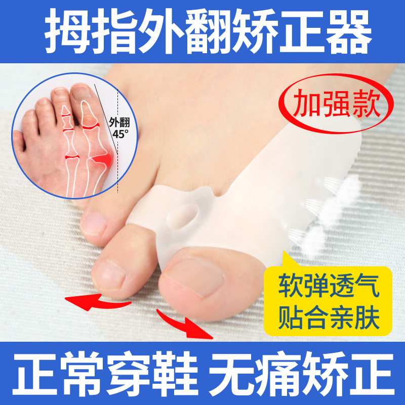 脚趾矫正器分趾器大母脚趾拇外翻大脚骨突出男女士矫正神器可穿鞋
