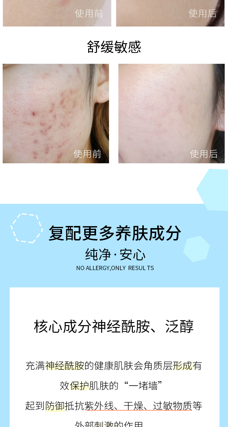 Hàn Quốc RNW Cream Ceramide Dưỡng ẩm Giữ ẩm cho Mùa Thu và Mùa Đông Làm săn chắc, Chống nếp nhăn Phục hồi Mẫu Da nhạy cảm