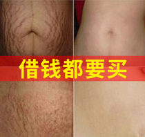 Day Department Gestational Veins Postpartum Repair Cream Obese tattooed with belly leather Pregnant Women Special for Pregnant Women Special