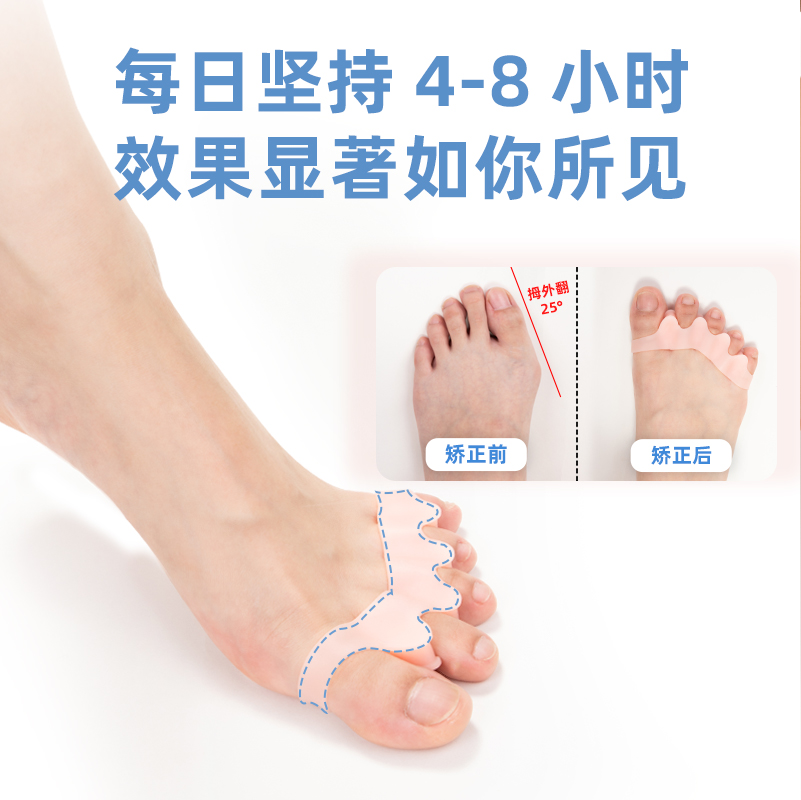 Thumb valgus corrector overlapping toe separator little toe valgus corrector yoga toe splitter men and women