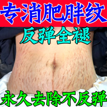 Stretch marks removal stretch mark tightening hormone mark expansion marks on belly obesity mark growth mark repair cream on thighs