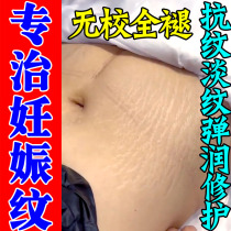Stretch marks removal pregnancy firming belly obesity removal cream postpartum repair cream scar cream growth marks 20