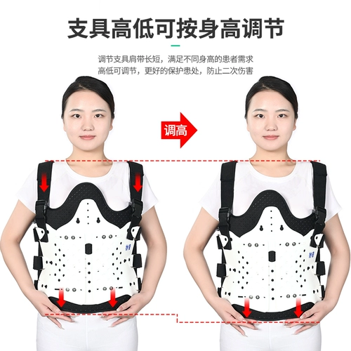 妙普 График грудной и поясничной фиксации позвоночника