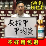 Nanjing tongrentangyeya Выделенная световая фармацевтическая подлинная удаление утолщающей бактерии инскоральная лечение туртеитом