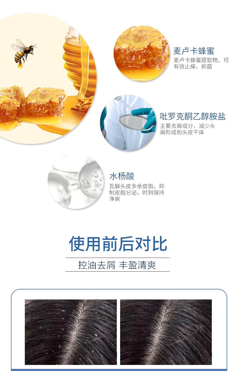 防脱三巨头之一：50ml Nizoral仁山利舒 止痒去屑防脱洗发水 19元包邮 值值值-买手聚集的地方