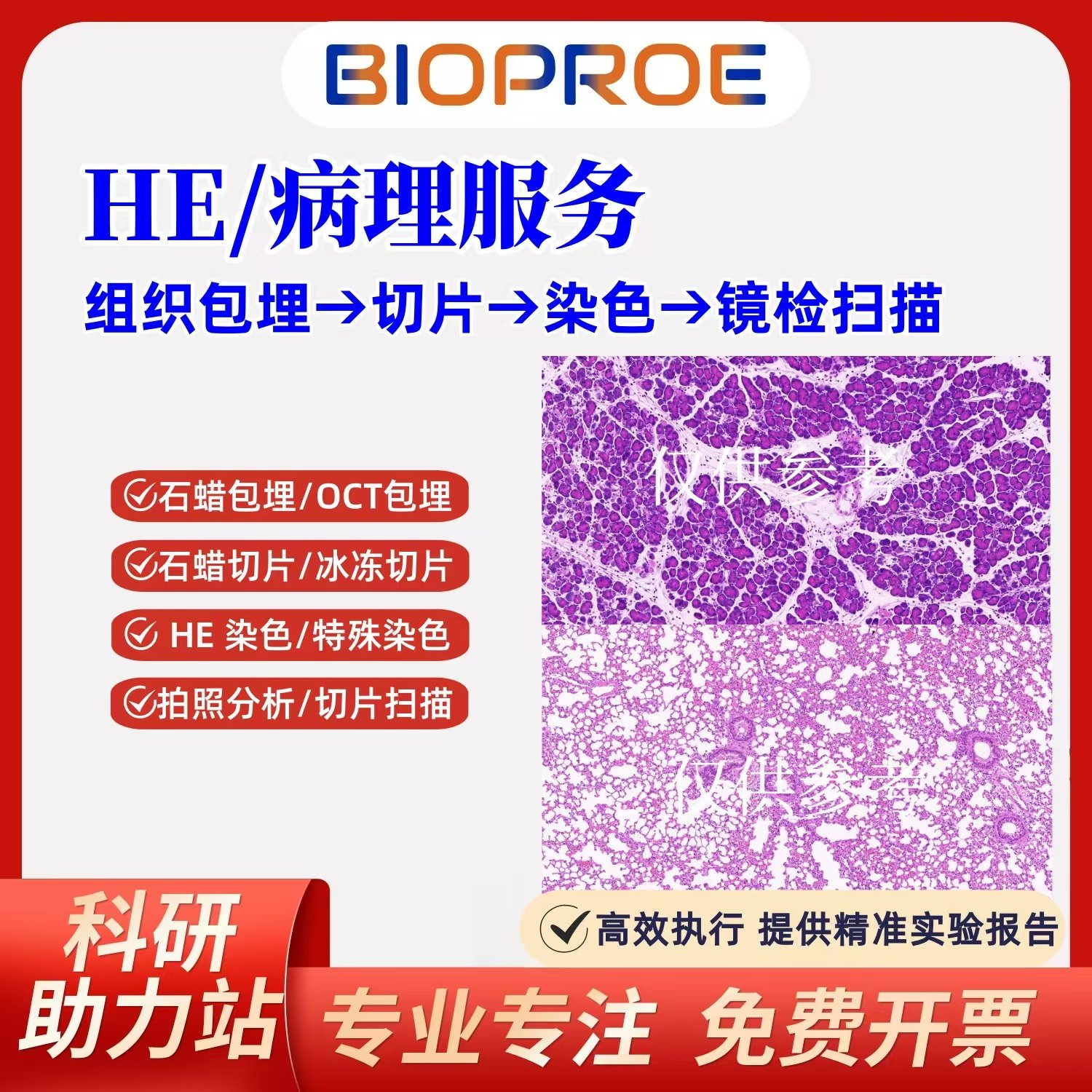 石蜡切片HE染色实验结果 HE病理分析HE检查报告
