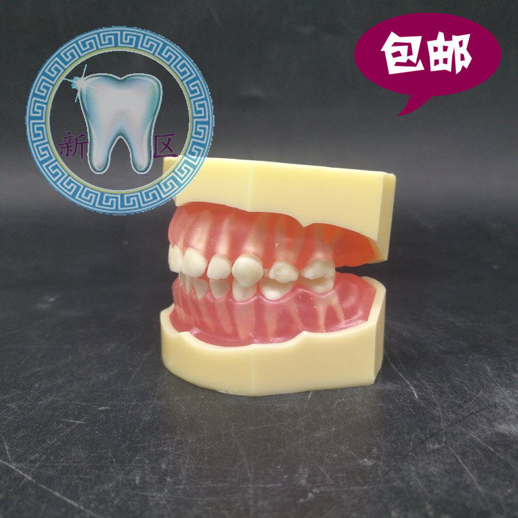 牙科 标准乳牙模型 儿童拔牙模型 20颗全口可拆仿真牙软牙龈 包邮