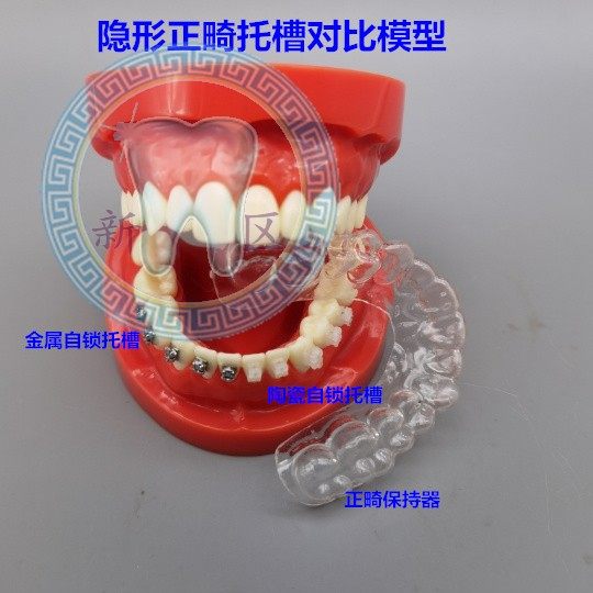 牙科 隐形正畸模型 保持器示范 陶瓷自锁金属自锁 4种托槽对比