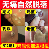 Hand foot foot and foot paste root Baiyun Mountain Callus artifact Hengjian mole Japanese ointment except for correction of foot chicken eye paste