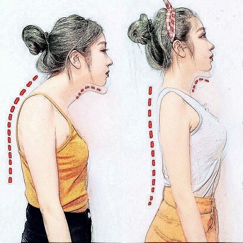 (Recommended by Wei Ya) Natural Invisible Breathable Confidence Correction Strap