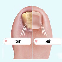 Sinopharm R&D drop ① drop grow well